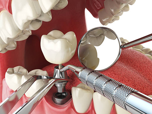 Best Urgent Dental Care in La Puente, CA